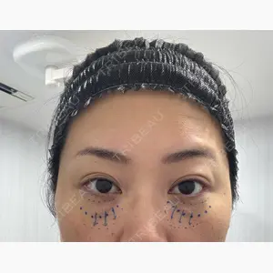 EMMO FACE CLINIC 東京三田院口コミ