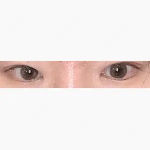 湘南美容クリニック 池袋東口院口コミ