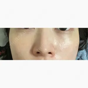 PureMe Skin Clinic（ピュアミースキンクリニック麻布）口コミ