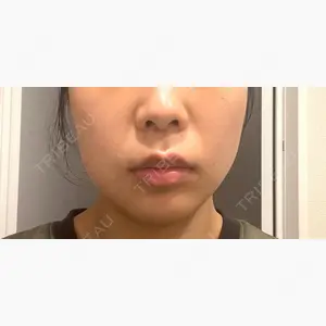 代々木駅前美容クリニック口コミ