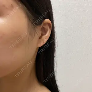 Natural Skin Clinic 笹塚院口コミ