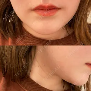 A CLINIC（エークリニック） 仙台院口コミ