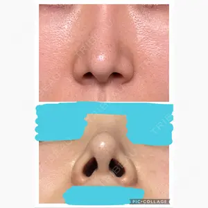 TJ美容外科口コミ