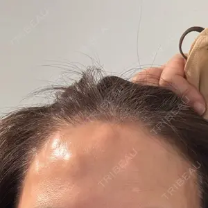 BON BON CLINIC 銀座駅前本院口コミ