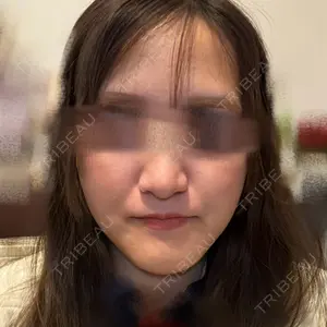 銀座マイアミ美容外科口コミ