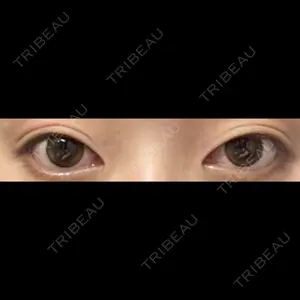 LUHO（ルホ）美容外科口コミ