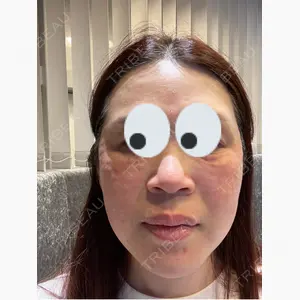 X CLINIC 大阪院口コミ