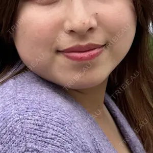 湘南美容クリニック 町田院口コミ
