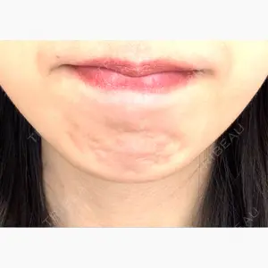 ルラ美容クリニック 名古屋本院口コミ