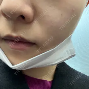 ルラ美容クリニック 渋谷本院口コミ
