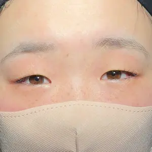 アリエル美容クリニック 大宮院口コミ