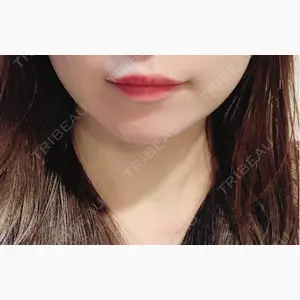 MIO CLINIC 梅田院口コミ