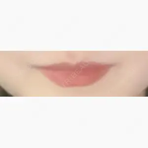 HAAB×DREAM BEAUTY CLINIC 大阪梅田院口コミ