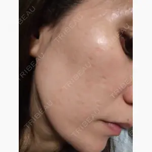 美容皮膚科 デュークリニック口コミ