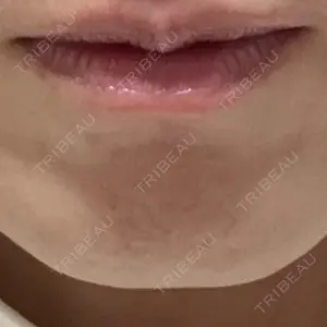 湘南美容クリニック 名古屋栄院口コミ