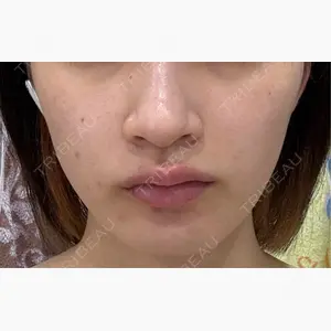 BON BON CLINIC 銀座駅前本院口コミ