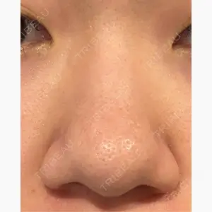 東京美専クリニック口コミ
