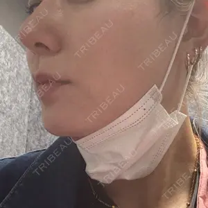 YBC横浜美容外科 池袋院口コミ