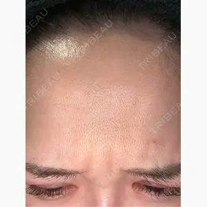 Zetith Beauty Clinic 福岡院口コミ