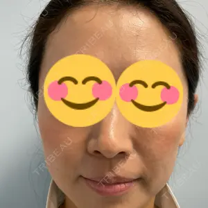 プラザ美容外科口コミ