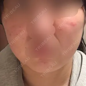 ゆきスキンクリニック 東池袋口コミ