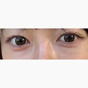 NARU Beauty Clinic 【ナルクリ】口コミ
