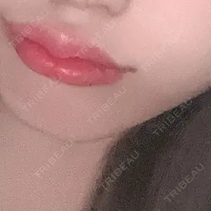 NARU Beauty Clinic 【ナルクリ】 水戸院口コミ