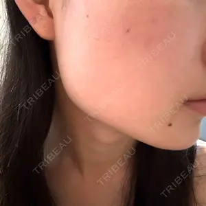 TCB東京中央美容外科 堺院口コミ