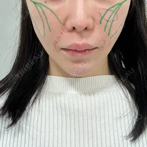 EMMO FACE CLINIC 東京三田院口コミ