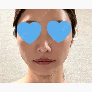 ルラ美容クリニック 東京駅前院口コミ