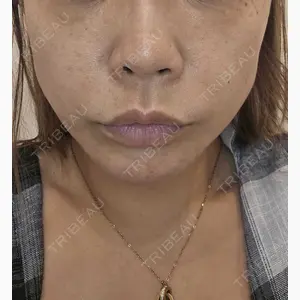 MIO CLINIC 梅田院口コミ