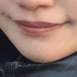 TCB東京中央美容外科 青森院口コミ