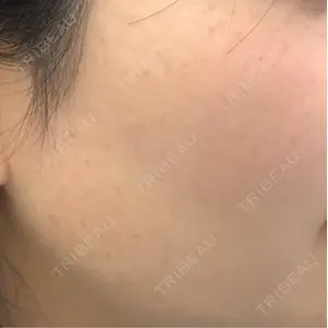 PureMe Skin Clinic（ピュアミースキンクリニック麻布）口コミ