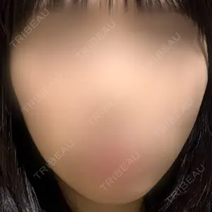 吉祥寺アイビークリニック口コミ