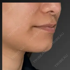 Lipo Clinic omotesando口コミ