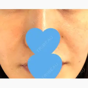 プラザ美容外科口コミ