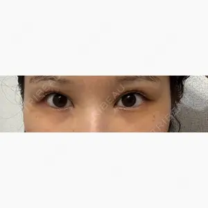 APOLLO BEAUTY CLINIC口コミ