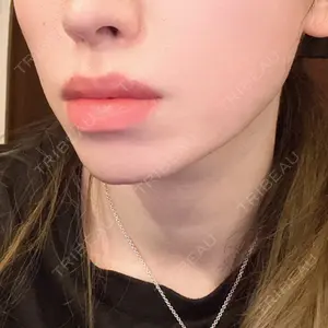 PRO CLINIC プロクリニック 銀座院口コミ