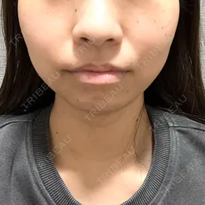 ルラ美容クリニック 大宮院口コミ