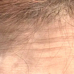 TCB東京中央美容外科 金山院口コミ