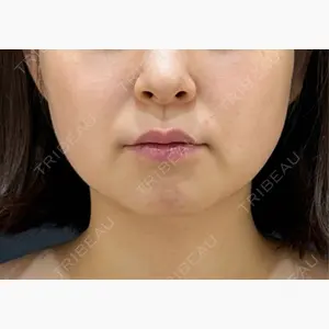 HAAB×DREAM BEAUTY CLINIC 東京本院口コミ