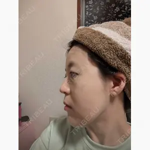 ルラ美容クリニック 大宮院口コミ