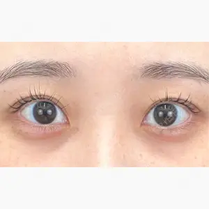 湘南美容クリニック 池袋東口院口コミ