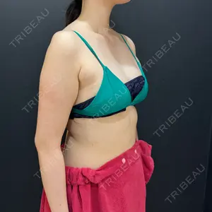 HAAB×DREAM BEAUTY CLINIC 東京本院口コミ
