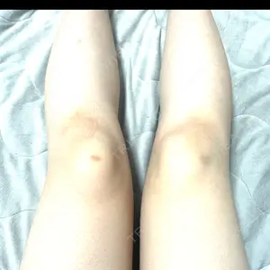 HAAB×DREAM BEAUTY CLINIC 大阪梅田院口コミ