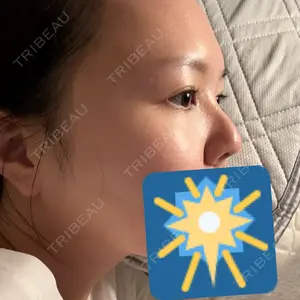 東京形成美容外科 船橋院口コミ