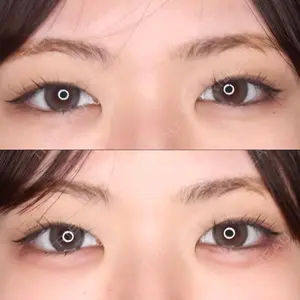 吉祥寺アイビークリニック口コミ