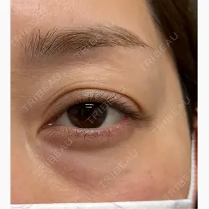 ネビュラクリニック 京都院口コミ