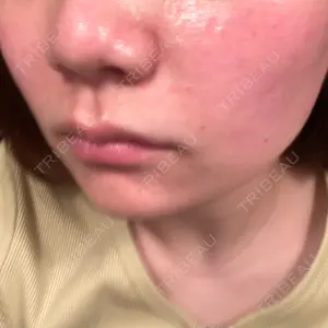 APスキンクリニック銀座口コミ