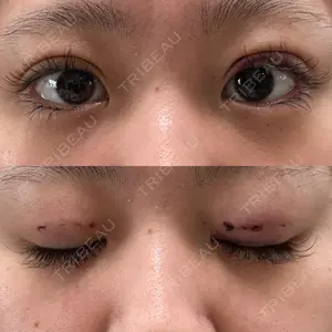 HAAB×DREAM BEAUTY CLINIC 大阪梅田院口コミ
